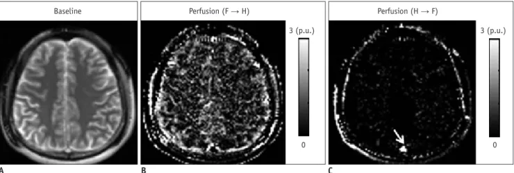 Figure 5 shows exemplary directional perfusion maps  obtained in the brain with a scan time of –3 minutes