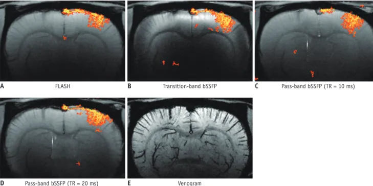 Fig. 7. Investigation of activation foci of high-resolution functional MRI maps. 