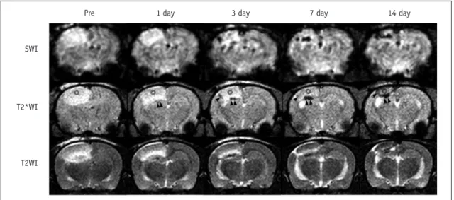 Fig. 4. Time-elapsed MR images of photothrombotic cerebral infarction and superparamagnetic iron oxide (SPIO)-labeled stem  cells in rat model.
