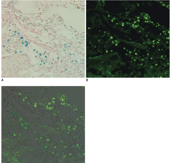 Fig. 6. Correlation between Prussian blue and immunohistochemistry (IHC) staining.