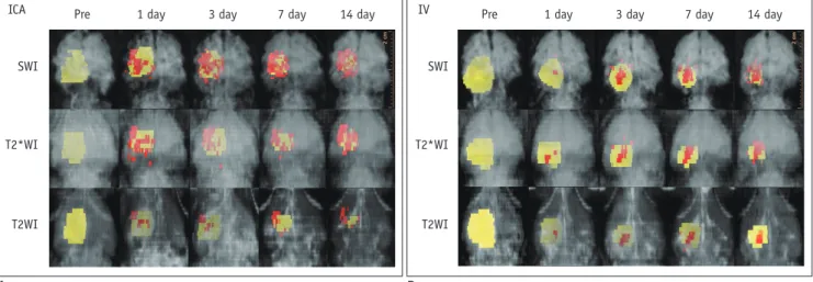 Fig. 7. Ventral perspective of three-dimensional reconstruction of MR images of photothrombotic cerebral infarction and  superparamagnetic iron oxide (SPIO)-labeled human bone marrow-derived mesenchymal stem cells (hBM-MSCs) in rats.