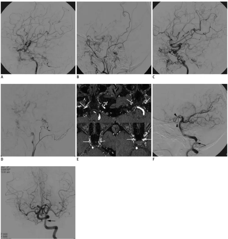 Fig. 1. 22-year-old woman presenting with recurrent syncope.