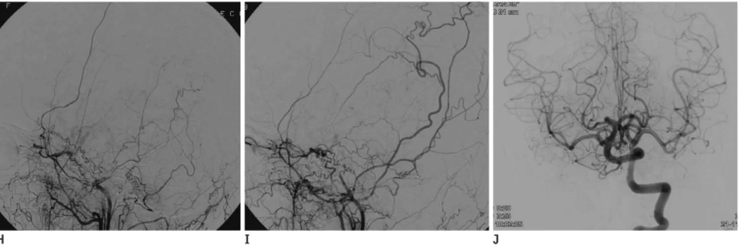 Fig. 1. 22-year-old woman presenting with recurrent syncope.