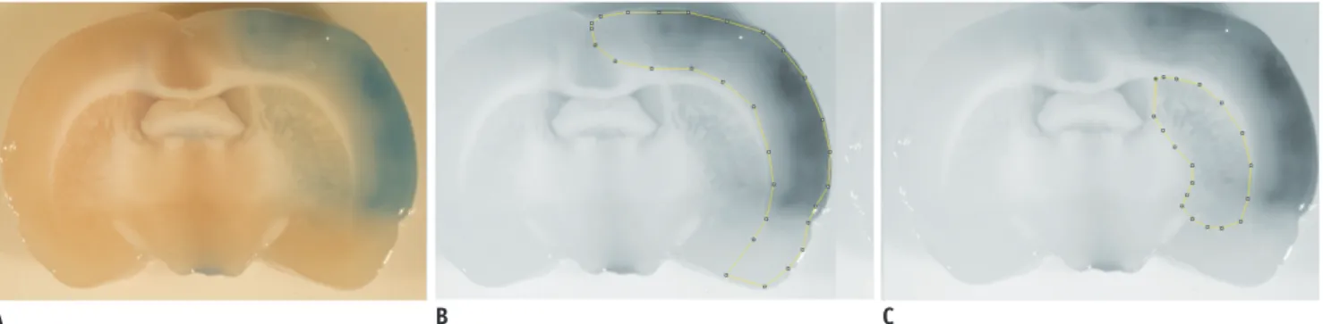 Fig. 3. Extravasation of Evans blue and K trans  map.