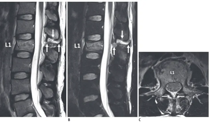 Fig. 3. Case of disagreement on injury morphology by readers. 