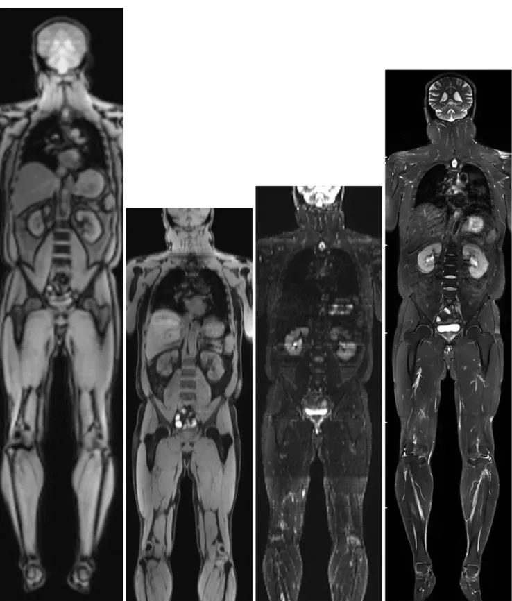 Fig. 9. Whole-body magnetic resonance imaging (MRI) using continuously moving table approach in adult volunteer.
