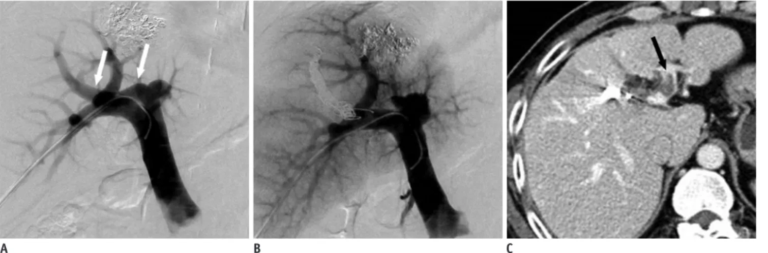 Fig. 8. 50-year-old man with hepatocellular carcinoma. 