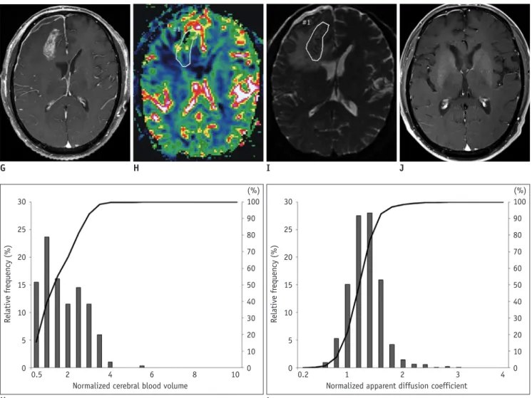 Fig. 1. Representative example of MR images, nCBV maps, nADC maps and corresponding histograms in 70-year-old man with  progression and in 60-year-old man with non-progression.