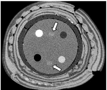 Fig. 3. CT image of module 1 of 40-cm phantom reconstructed  with adaptive iterative dose reduction three-dimensional  standard mode at tube current time product of 180 mAs,  showing alignment line (arrows).