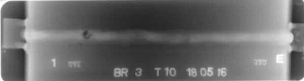 Fig.  1  An  example  of  RT  film  (welding  bead  of  pipes)