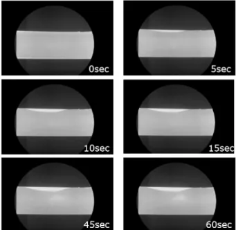 Fig. 11. X-ray observation of AC4C alloy solidification (experiment 2).
