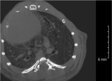 Fig. 2. Mouse lung imaging performed using micro-CT scanner. 