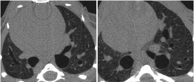 Fig. 4. Normal micro-CT finding of control mice.  Micro-CTs of control mice show all normal findings at 3 and 6 weeks after intratracheal  saline instillation.