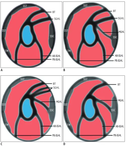 Fig. 8. Types of variations in shape and size of SGHL.