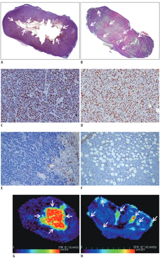 Fig. 4. Relationship between ADC maps and histopathological results. 