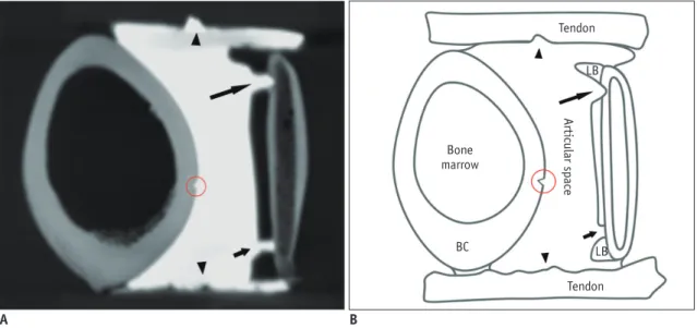 Fig. 1. Reconstructed coronal CT image (A) and schematic drawing (B) of shoulder phantom.
