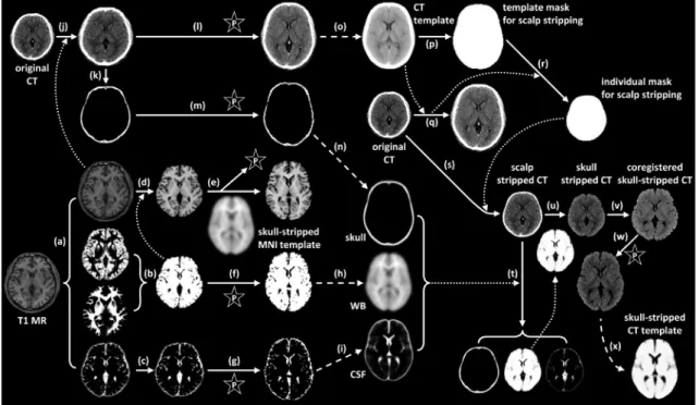 Fig. 1. Image processing steps for acquiring skull-stripped CT template. 