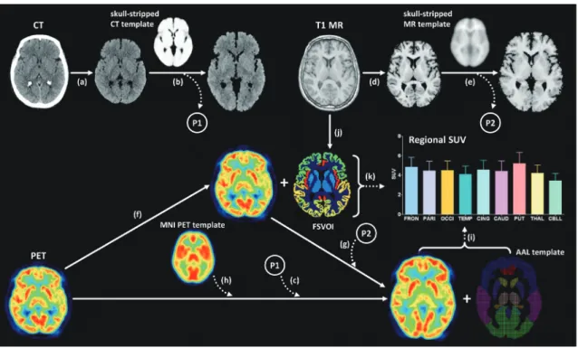 Fig. 2. Image processing steps for three methods of spatial normalization and measuring regional SUV.