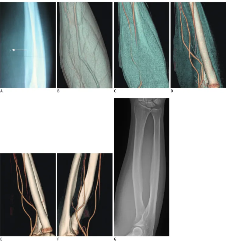 Fig. 1. False positive of soft-tissue FB detected by radiograph.