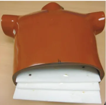 Fig. 1. Anthropomorphic chest phantom for evaluation of  image quality.  Three sets of Styrofoam embedded with artificial  nodules were inserted into empty chest phantom.