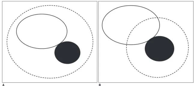 Fig. 1. Schematic diagrams illustrating complete and partial ablation of area of iodized oil retention for targeting.