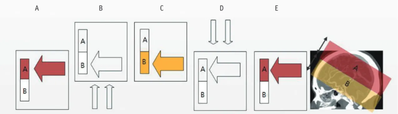 Fig. 2.  Perfusion maps of cerebral blood volume (CBV), cerebral blood flow (CBF), mean transit time (MTT), and time-to-peak (TTP)  obtained by toggling table technique (Jog mode)