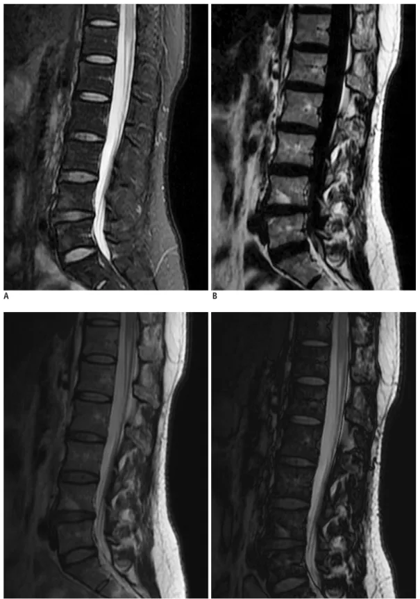 Fig. 1. 41-year-old woman with lower back pain.