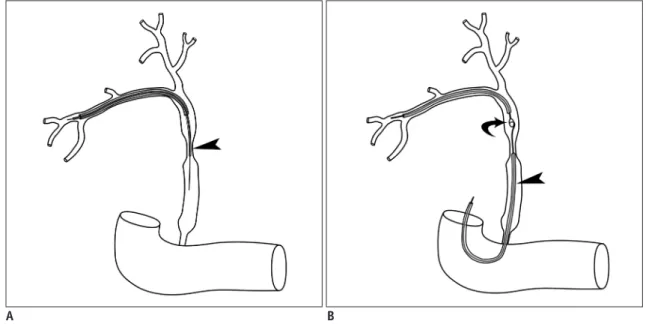 Fig. 1. Schematic drawings of two alternative techniques.