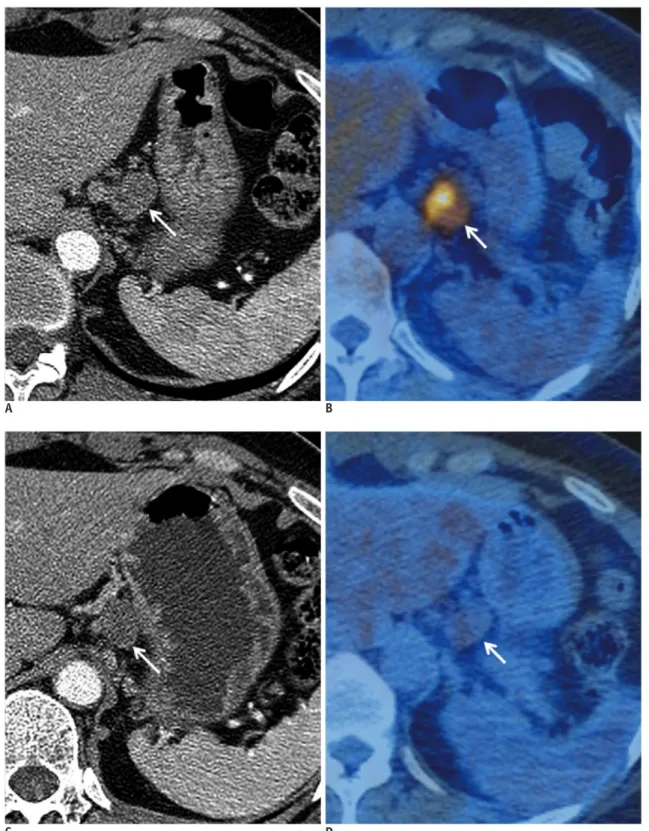Fig. 7. 44-year-old woman with esophageal cancer and multiple metastases.
