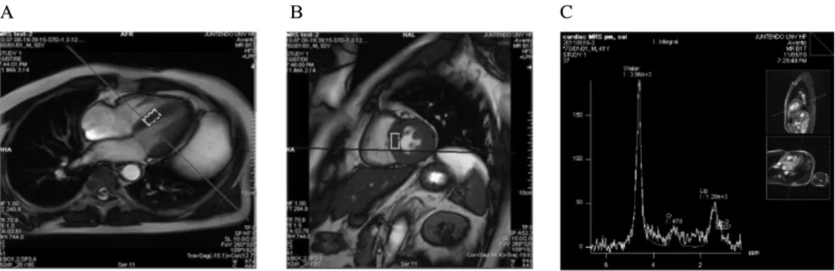 Fig.  4.  MR  imaging  with  1H-MRS  localization  and  corresponding  spectrum  in  vivo
