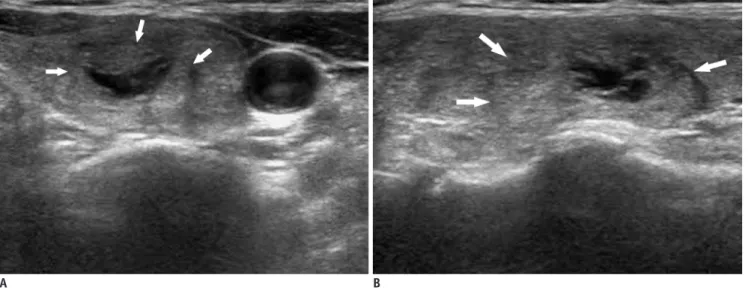 Fig. 2. Example of non-eccentric configuration of internal solid portion. 