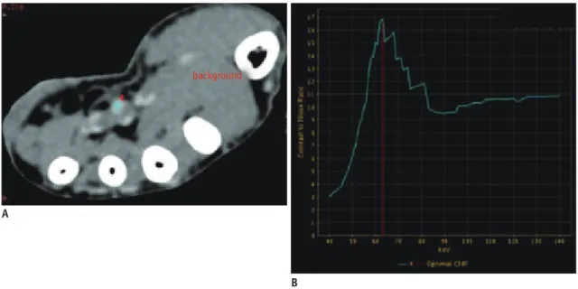 Table 3. Normal Hand Tendon Display with GSI (20 Normal Hands)