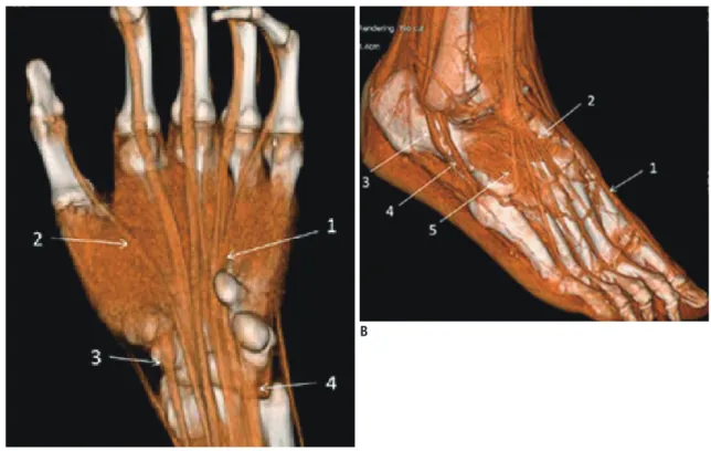 Fig. 2. Normal tendons (volume rendering images).