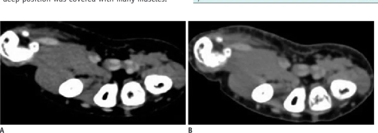 Fig. 3. Comparison with different imaging modalities.