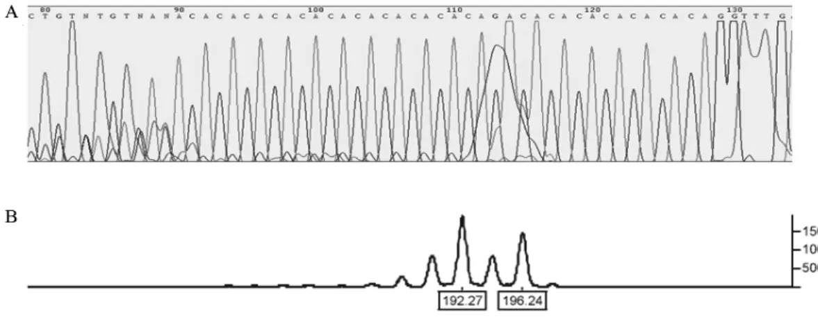 Fig.  1.  Capillary  electrophoresis.  A.  1  CA  repeat  heterozygote  type.  B.  4  CA  repeat  heterozygote  type