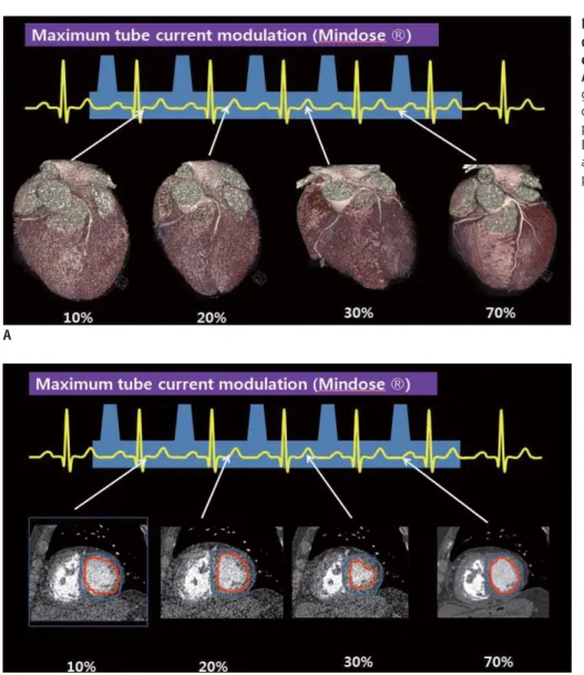 Fig. 4. Difference of image quality  depending on exposed maxinum tube  current.