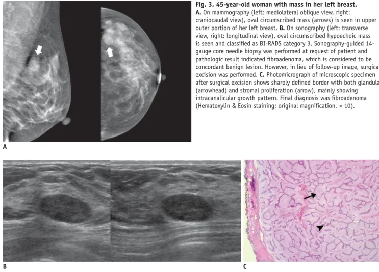 Fig. 3. 45-year-old woman with mass in her left breast.