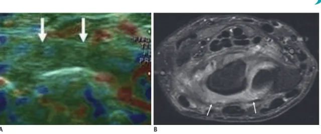 Fig. 9. Hemangioma.
