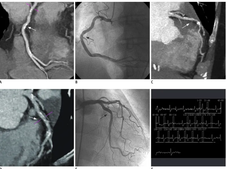 Fig. 3. Relationship between heart rate and cardiac phase that  provided for optimal image quality.