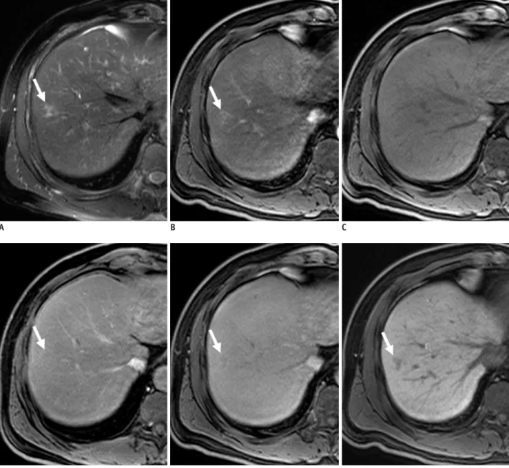 Table 2 summarizes the different MRI features observed 