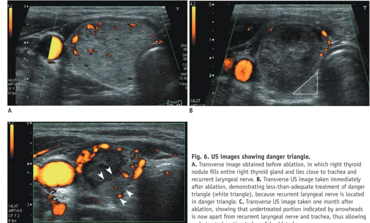 Fig. 6. US images showing danger triangle. 