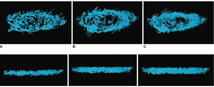 Table 1. Quantitative Analysis of Fractional Anisotropy and Fiber Tracking According to Number of Diffusion Gradient Directions 