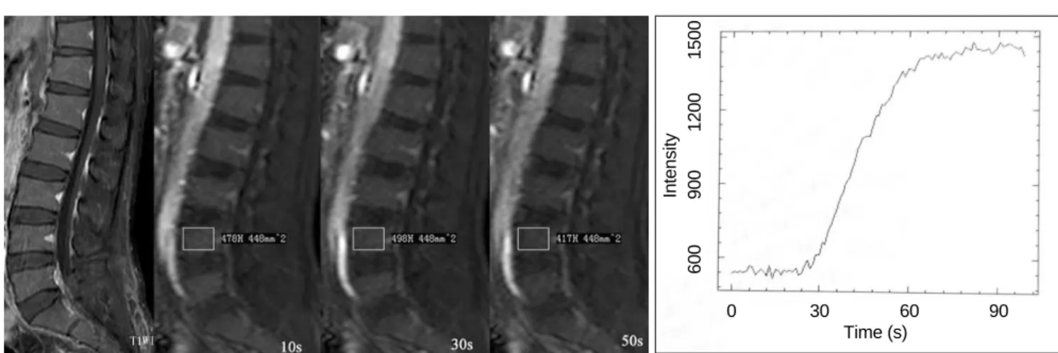 Fig. 3. 35-year-old man in normal control group. 