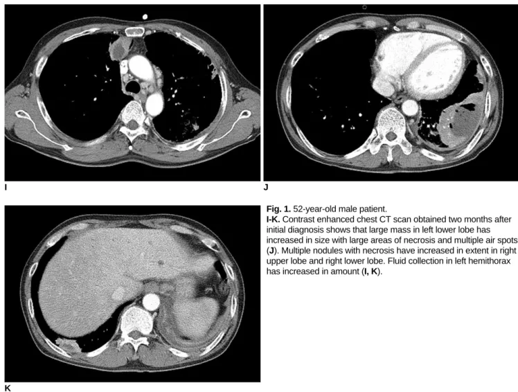 Fig. 1. 52-year-old male patient. 