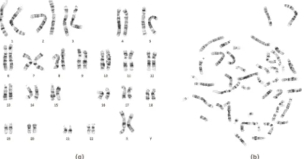 Fig.  1  (a)  Karyotype  Image  and  (b)  Metaphase  chromosome  image.