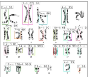Fig.  3  mAP  performances  of  faster  R-CNN  with  VGG16  according  to  the  optimizers