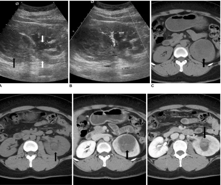 Fig. 1. Imaging findings are presented for 41-year-old woman with cystic embryonal sarcoma.