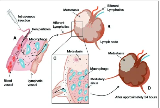 Table 1 summarizes the contrast medias that have been reported on in the literature for contrast-enhanced LNMRI (12, 16, 17, 19, 21-24, 27, 29-43)