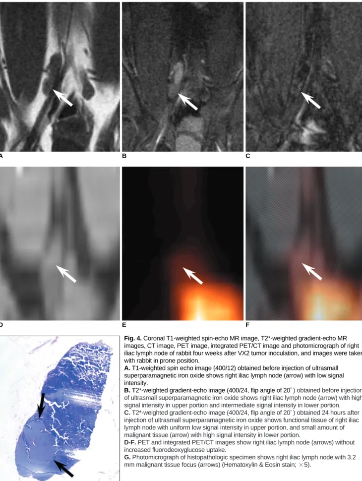 Fig. 4. Coronal T1-weighted spin-echo MR image, T2*-weighted gradient-echo MR images, CT image, PET image, integrated PET/CT image and photomicrograph of right iliac lymph node of rabbit four weeks after VX2 tumor inoculation, and images were taken with ra