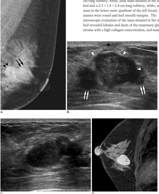 Fig. 1. 43-year-old female patient.